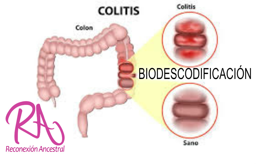 Cancer de colon biodescodificacion